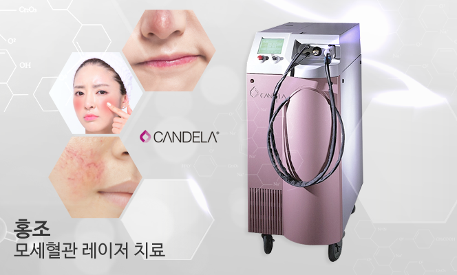 청담연세피부과 모세혈관레이저
